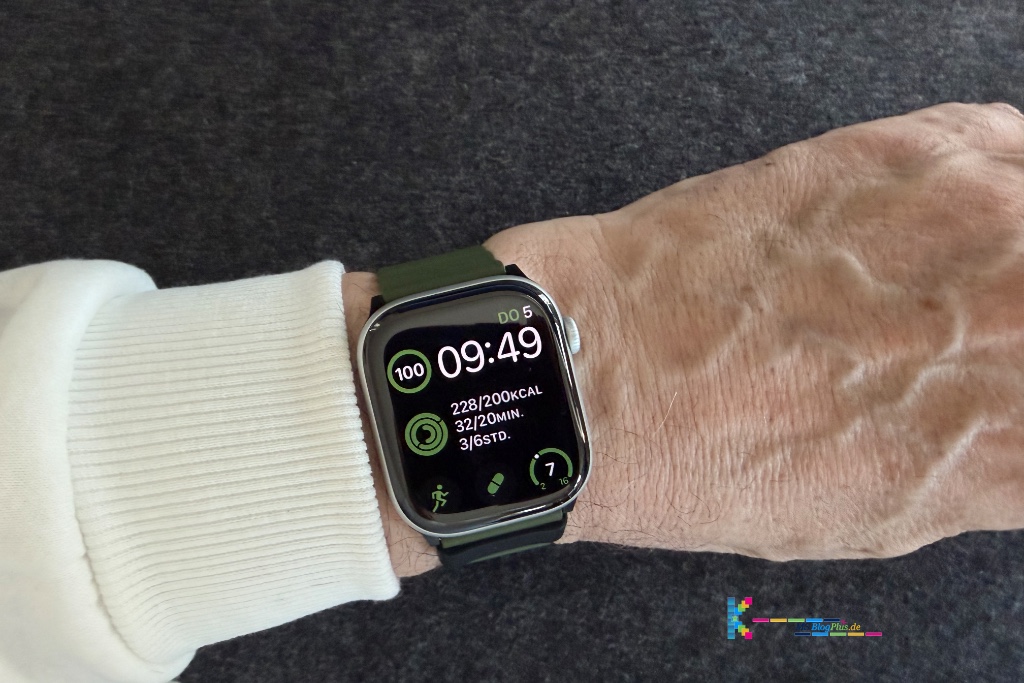 Erfahrungsbericht der Apple Watch Series 11